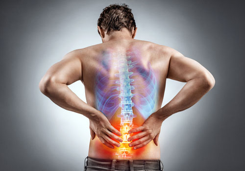 sciatica lower back pain